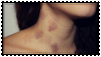 hickey stamp
