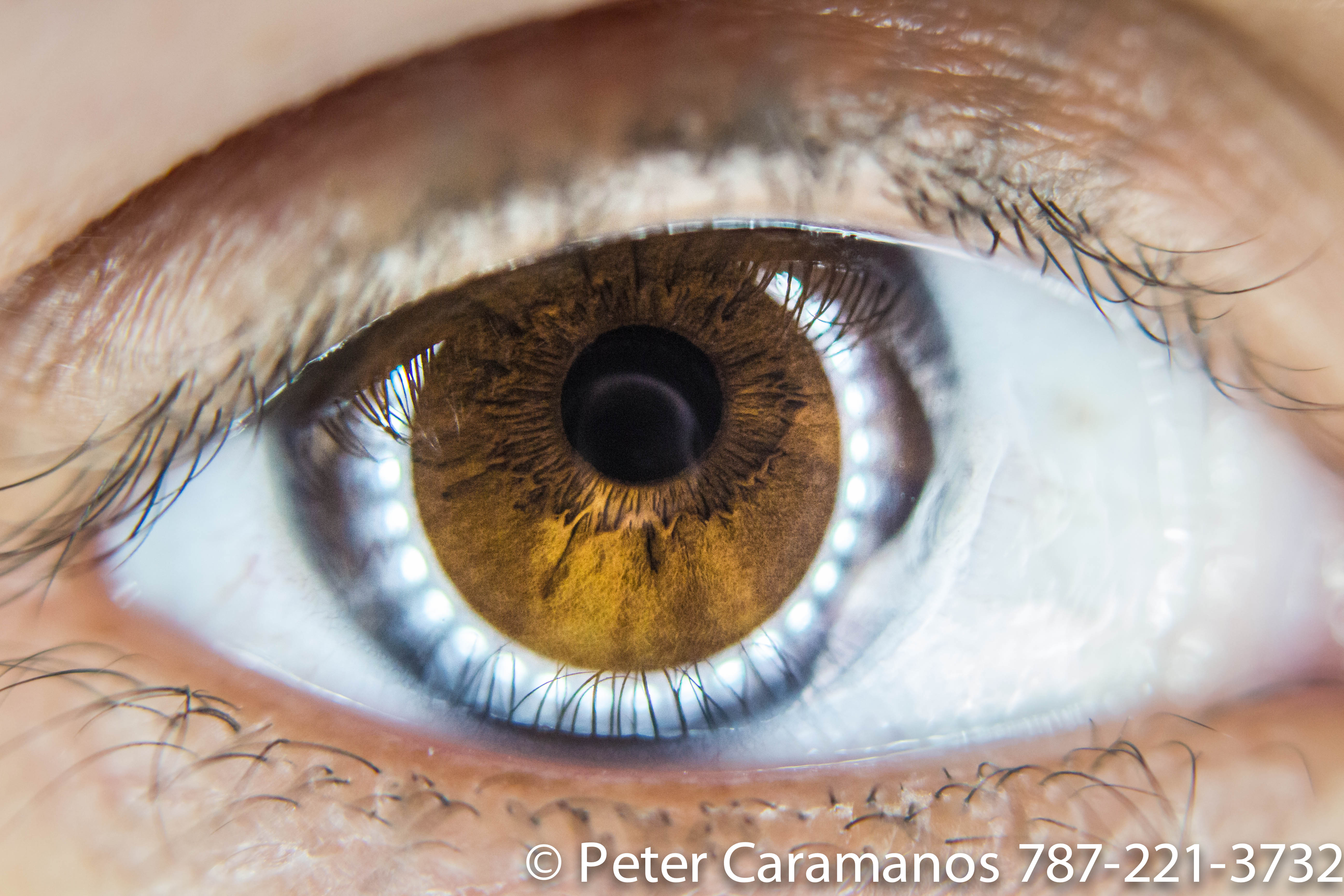 Brown Eye (LOL) Macro with ring light and EOS-M