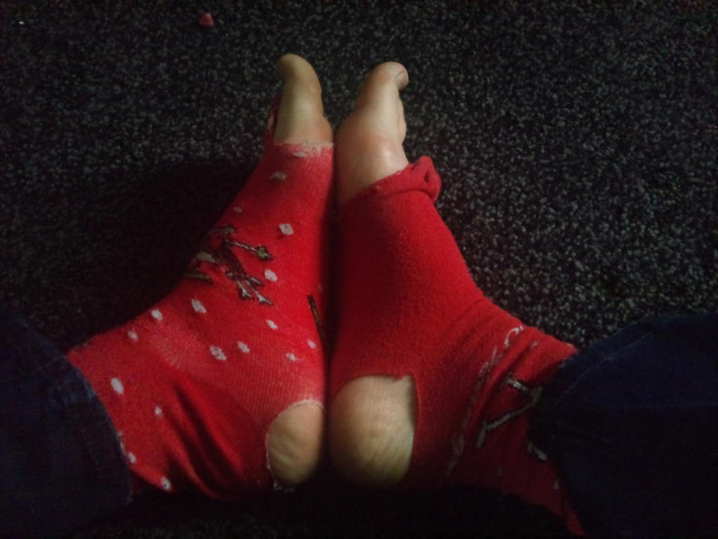 Magic Toe magic toes by Froglet-Thing on DeviantArt