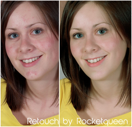 Retouch