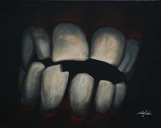 Bruxism