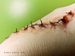 Stitches Close up by Guirnou