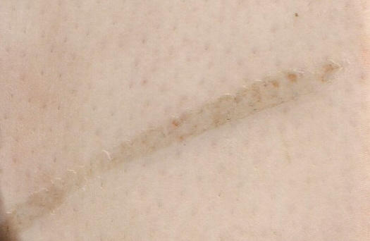 Light Rope Burn ROPE BURN by BabyFoxKit1 on DeviantArt