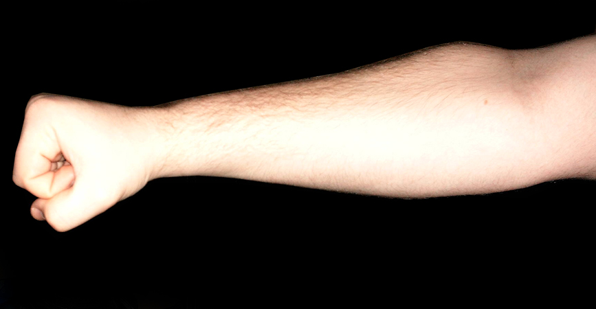 Fist -Forearm 1