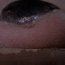 Dust Mites - Image 2