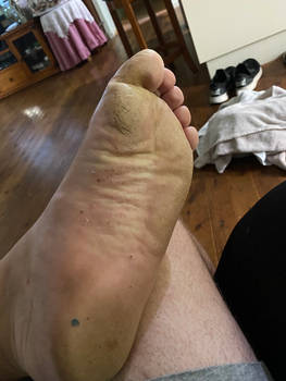 My foot