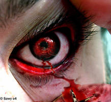 ..Blood+Shot+Eye..