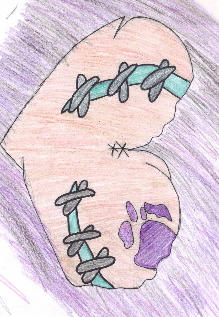Deviantart Stitched The deformed stitched heart by codylover1152 on DeviantArt