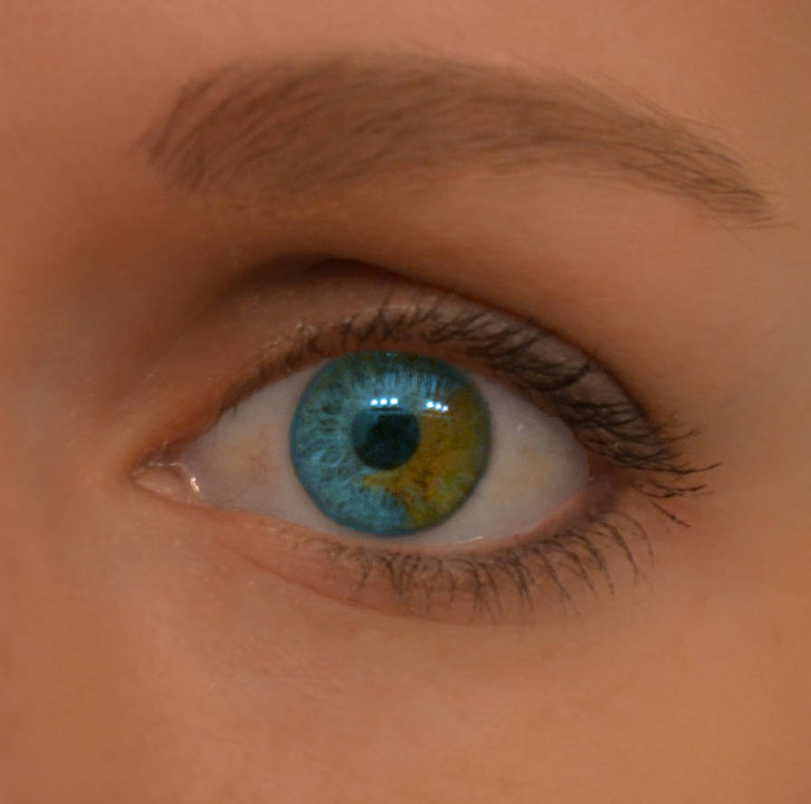 Как называется когда у человека разные глаза. Болотный цвет глаз гетерохромия. Цветные линзы гетерохромия. Центральная гетерохромия серо-зеленые. Гетерохромия зеленый и Карий.