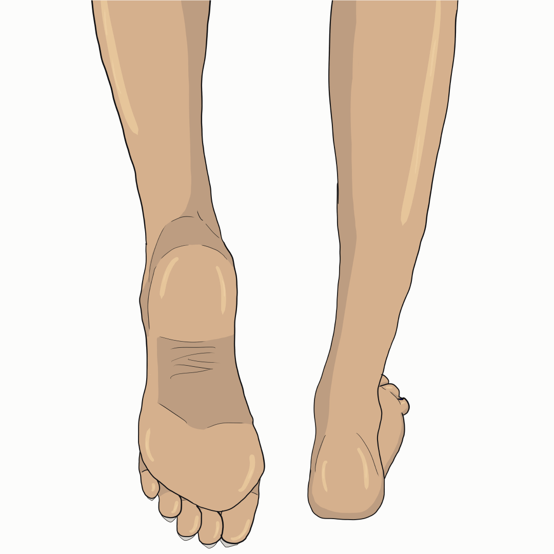 Lead Foot Gif at Karen Evans blog
