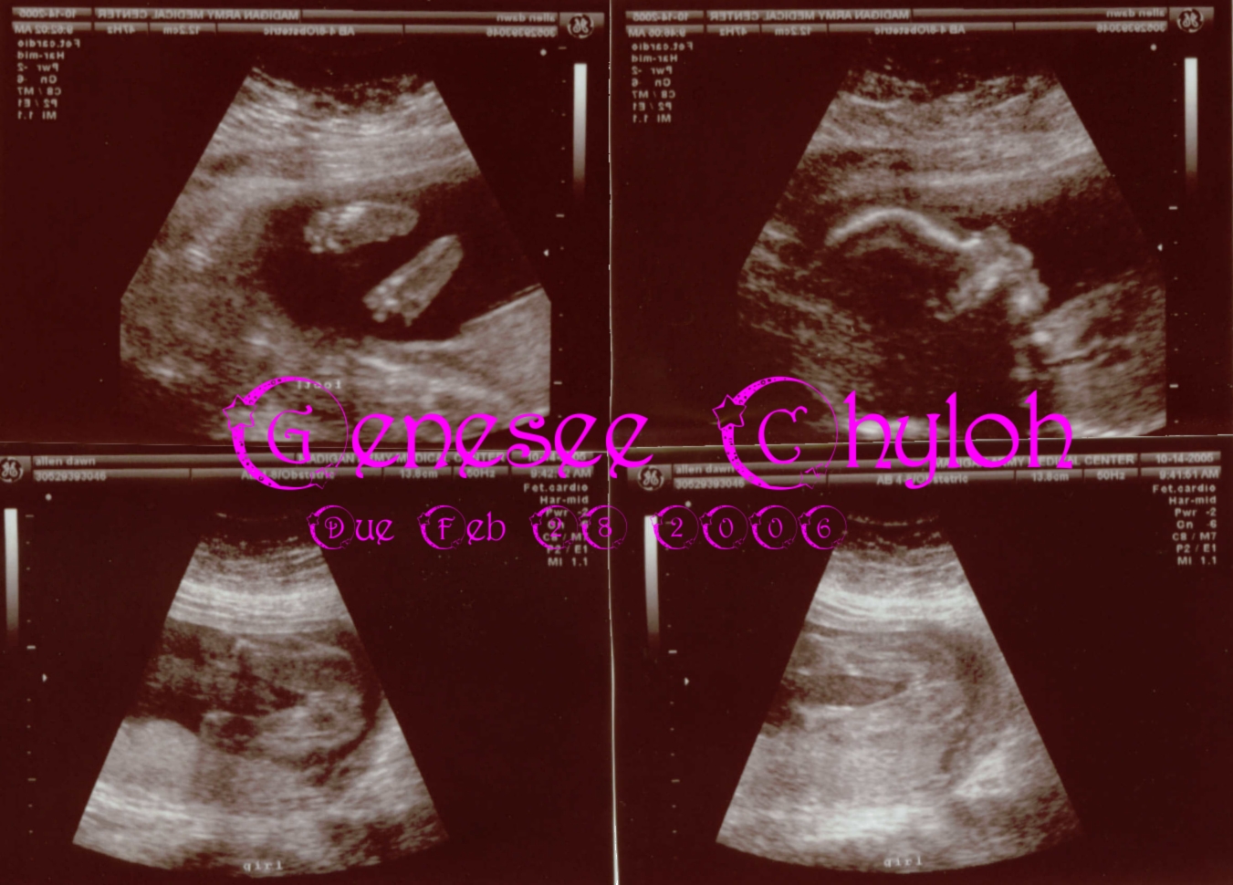 Sonogram Oct 14, 2006