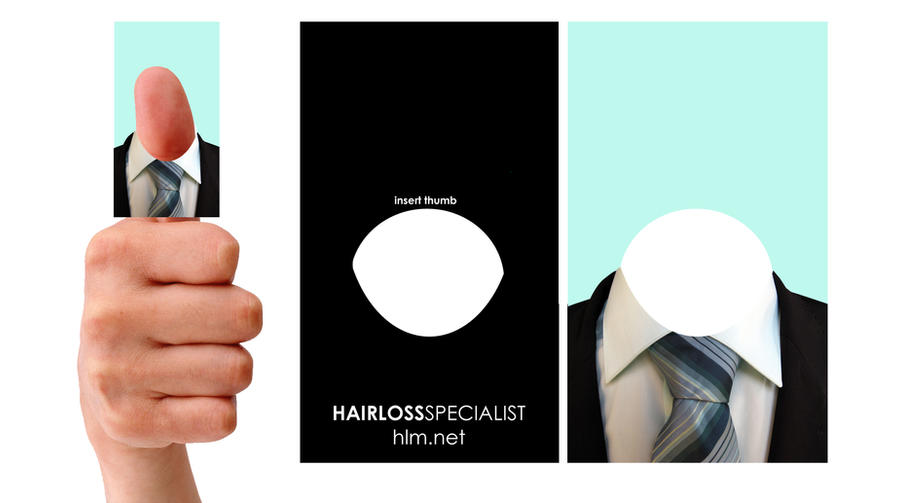Hairloss company Business card