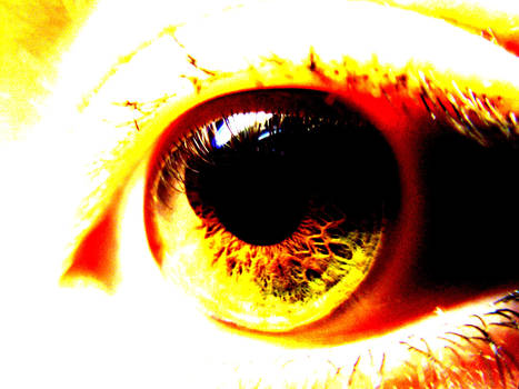 My Eye Picture4