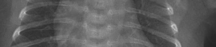 IntrauterineHypoxie1.jpg