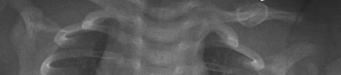 IntrauterineHypoxie1.jpg