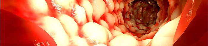 Colitis-ulcerosa1.jpg