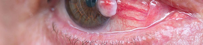 desmesothelialenGewebes1.jpg
