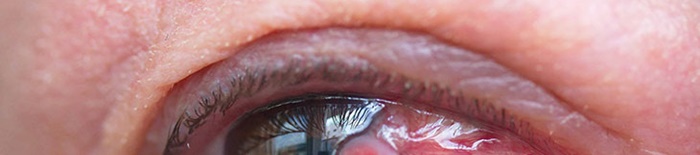 desmesothelialenGewebes1.jpg