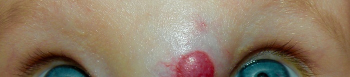 desmesothelialenGewebes1.jpg
