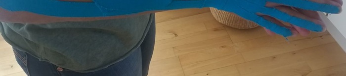IntrakranielleVerletzung1.jpg