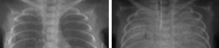 IntrauterineHypoxie1.jpg