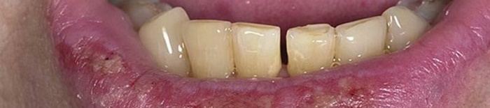 desmesothelialenGewebes1.jpg