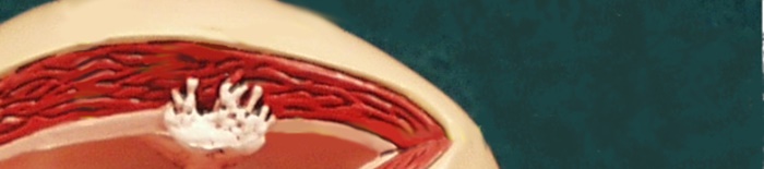 desmesothelialenGewebes1.jpg