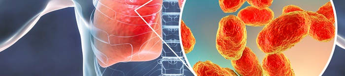 PneumonieKrankheitenandernorts1.jpg