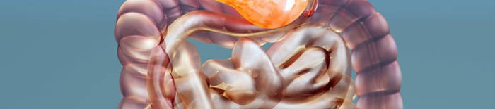 HydropsfetalisdurchhamolytischeKrankheit169c89eaccf1e99ff.jpg