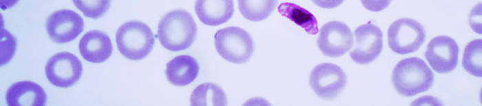Dermatophytose1.jpg