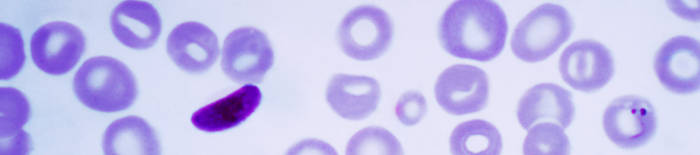Dermatophytose1.jpg