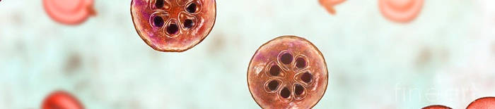 Dermatophytose1.jpg