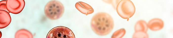 Dermatophytose1.jpg