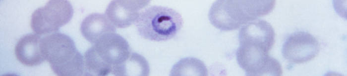 Dermatophytose1.jpg