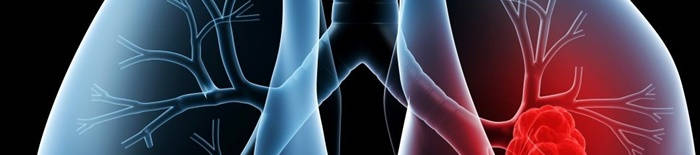 desmesothelialenGewebes1.jpg