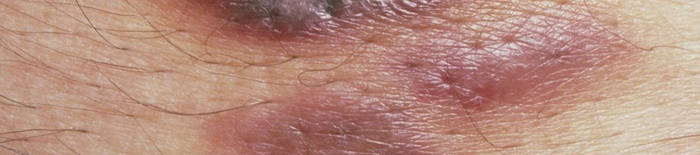 desmesothelialenGewebes1.jpg