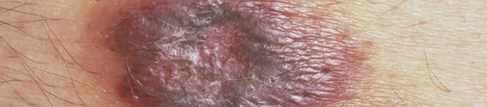 desmesothelialenGewebes1.jpg
