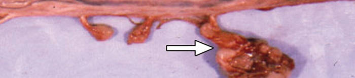 desmesothelialenGewebes1.jpg