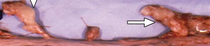 desmesothelialenGewebes1.jpg
