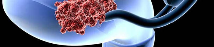 desmesothelialenGewebes1.jpg