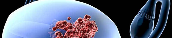 desmesothelialenGewebes1.jpg