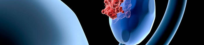 desmesothelialenGewebes1.jpg