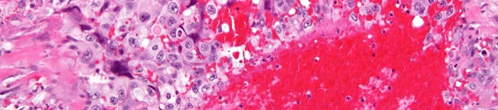 desmesothelialenGewebes1.jpg