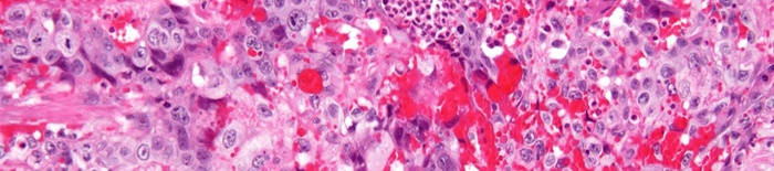 desmesothelialenGewebes1.jpg