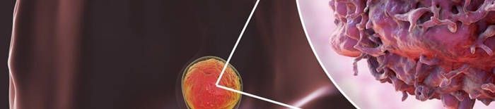 desmesothelialenGewebes1.jpg
