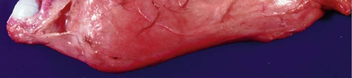 desmesothelialenGewebes1.jpg