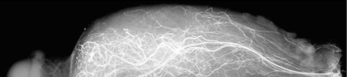desmesothelialenGewebes1.jpg