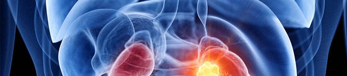 desmesothelialenGewebes1.jpg