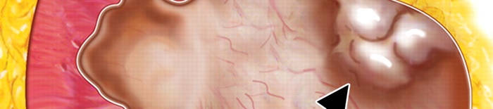desmesothelialenGewebes1.jpg