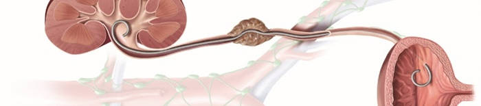 desmesothelialenGewebes1.jpg